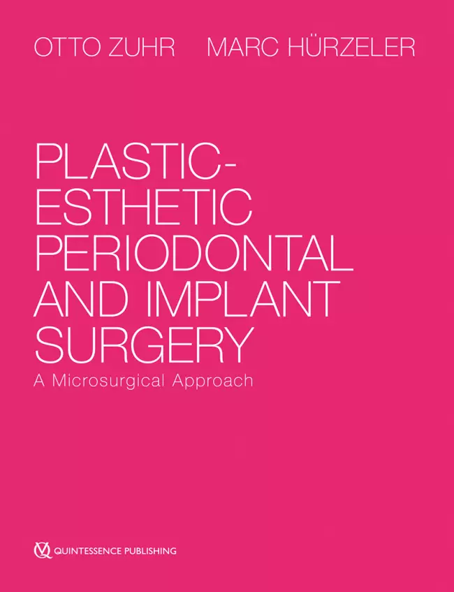 Plastic-Esthetic Periodontal and Implant Surgery A Microsurgical Approach - Pdf